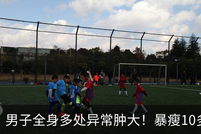 男子全身多处异常肿大！暴瘦10多斤！嘉定瑞金医院：不是癌却像癌！